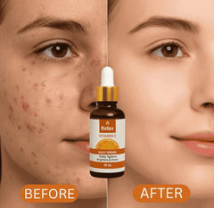 Relax Vitamin C Daily Face Serum – Brightening, Anti-Aging & Hydrating Formula For Healthy Radiant Skin (30ml)